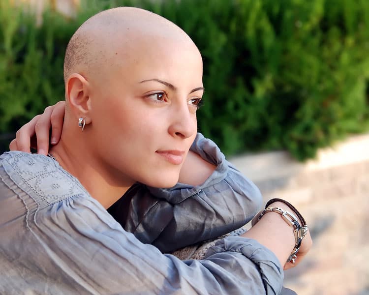 Krebskranke Frau ohne Haare